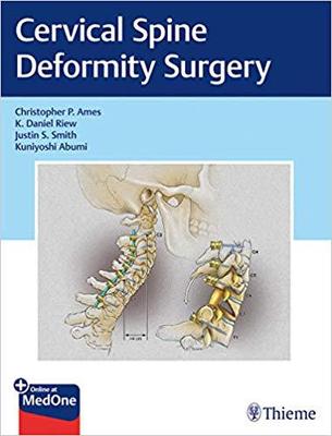 【预售】Cervical Spine Deformity Surgery