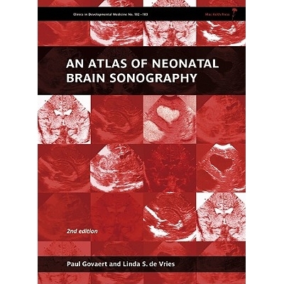预订 An Atlas of Neonatal Brain Sonography - Clinics Indevelopmental Medicine 2E 新生儿大脑超声波检查图解: 9781898683568