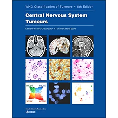 Central Nervous System Tumours *神经系统肿瘤: 9789283245087