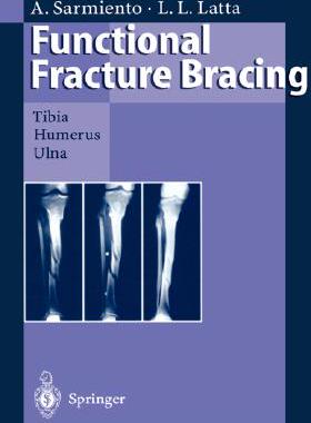 【预订】Functional Fracture Bracing