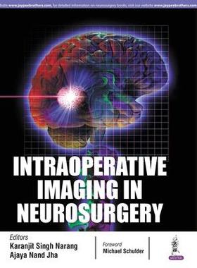 [预订]Intraoperative Imaging in Neurosurgery 9789386322906