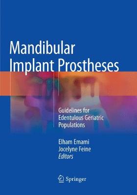 【预订】Mandibular Implant Prostheses 书籍/杂志/报纸 原版其它 原图主图