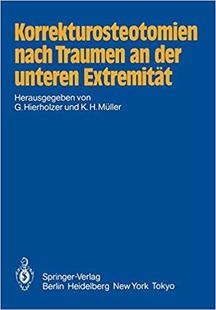nach Traumen Extremität 预订 9783642698095 unteren Korrekturosteotomien der