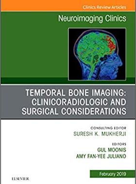 【预售】Temporal Bone Imaging: Clinicoradiologic and Surgical Considerations, An Issue of Neuroimaging Clinics of ...
