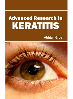 预订 Advanced Research in Keratitis 角膜炎的*研究: 9781632420251