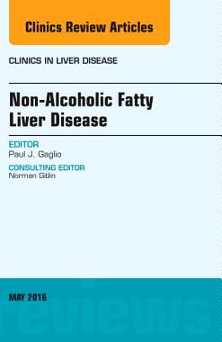 【预订】Non-Alcoholic Fatty Liver Disease, An Issue of Clinics in Liver Disease