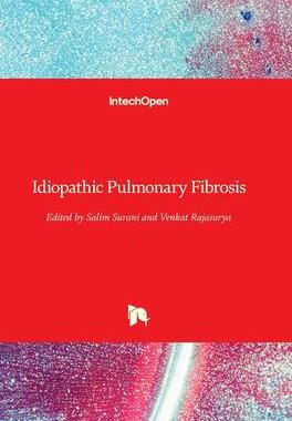 [预订]Idiopathic Pulmonary Fibrosis 9781839692390