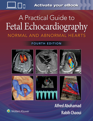 【预订】A Practical Guide to Fetal Echocardiography: Normal and Abnormal Hea 9781975126810