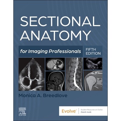 预订 Sectional Anatomy for Imaging Professionals 影像专业人员的断层解剖学 9780323827881