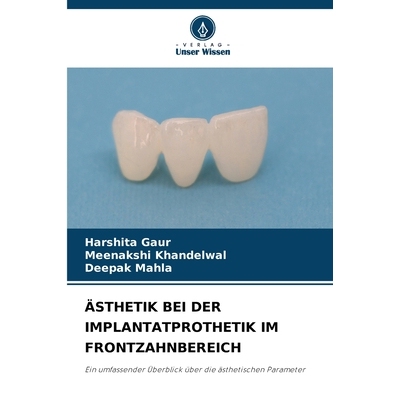 预订 ÄSTHETIK BEI DER IMPLANTATPROTHETIK IM FRONTZAHNBEREICH: Ein umfassender Überblick über die ästhetischen Parame