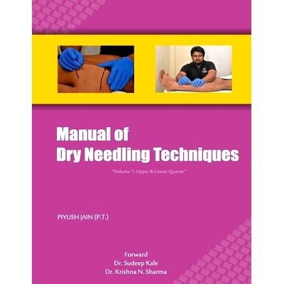 预订 Manual of Dry Needling Techniques: 9788192426723
