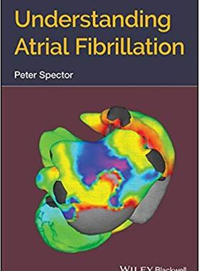 【预售】Understanding Atrial Fibrillation