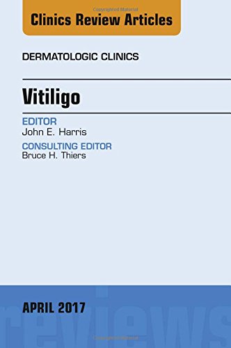 【预订】Vitiligo, An Issue of Dermatologic Clinics - 实物图