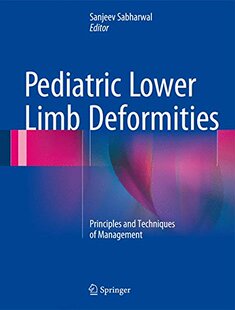 Lower 预订 Pediatric Deformities Limb