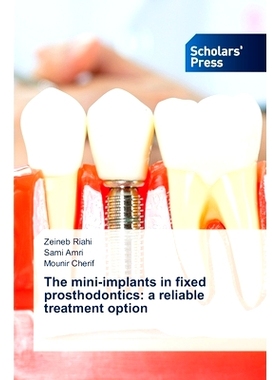 预订 The mini-implants in fixed prosthodontics: A reliable treatment option 固定修复中的微型种植体：一种可靠的治疗选择: