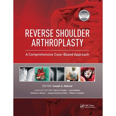预订 Reverse Shoulder Arthroplasty A Comprehensive Case-Based Approach 反向肩关节置换术：基于案例的综合方法 978163091685