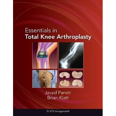 预订 Essentials in Total Knee Arthroplasty 全膝关节置换术要点 9781556428517
