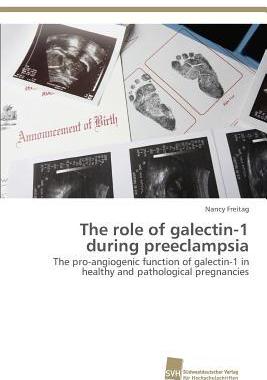 [预订]The role of galectin-1 during preeclampsia 9783838150567