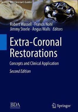 【预订】Extra-Coronal Restorations