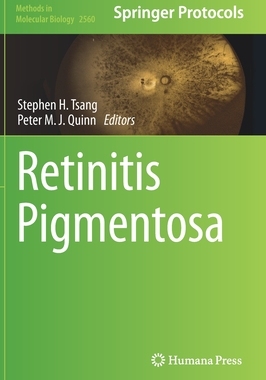 [预订]Retinitis Pigmentosa