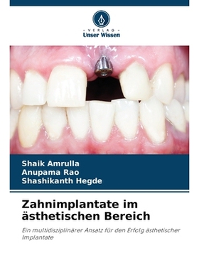 预订 Zahnimplantate im ästhetischen Bereich: Ein multidisziplinärer Ansatz für den Erfolg ästhetischer Implantate. D