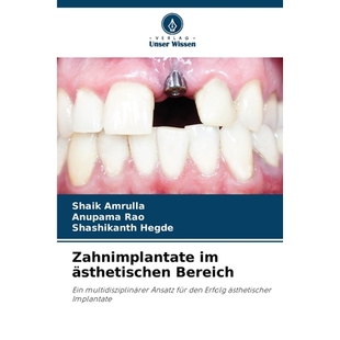 预订 Zahnimplantate im ästhetischen Bereich: Ein multidisziplinärer Ansatz für den Erfolg ästhetischer Implantate. D
