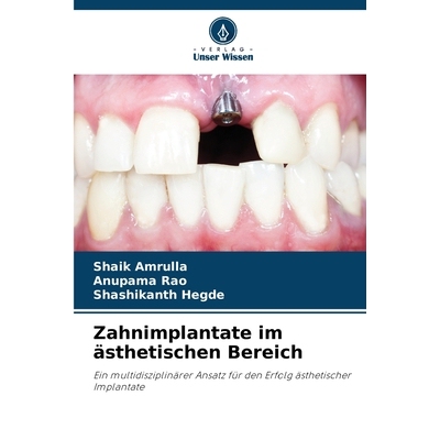 预订 Zahnimplantate im ästhetischen Bereich: Ein multidisziplinärer Ansatz für den Erfolg ästhetischer Implantate. D