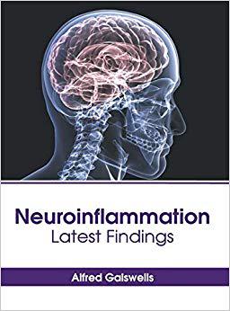 【预售】Neuroinflammation: Latest Findings