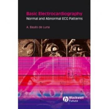 Normal and Abnormal ECG Patterns
