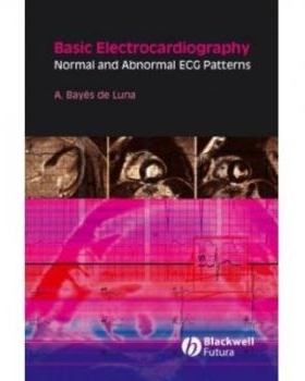 预订 Basic Electrocardiography - Normal And Abnormal Ecg Patterns 基础心电图描记器：正常与异常心电图模式: 9781405175708