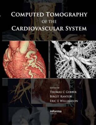【预订】Computed Tomography of the Cardiovascular System