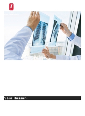 预订 Taxas de recorrência do cancro após cirurgia conservadora da mama: 9786209317248