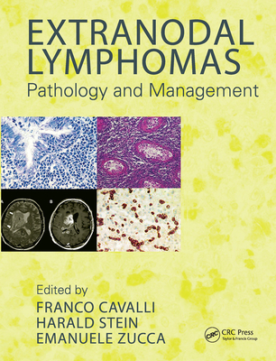 【预订】Extranodal Lymphomas: Pathology and Management