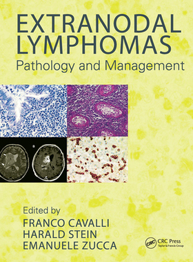 【预订】Extranodal Lymphomas: Pathology and Management