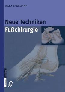 Fusschirurgie Techniken 预订 Neue