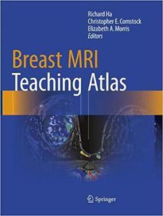 预售 Atlas Breast Teaching Softcover... MRI
