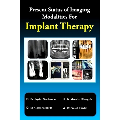 预订 Present Status of Imaging Modalities For Implant Therapy: 9789354461989