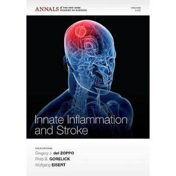 美国库房发货,通常付款后5-8周到货!