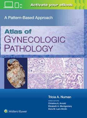 [预订]Atlas of Gynecologic Pathology: A Pattern-Based Approach 9781975124762