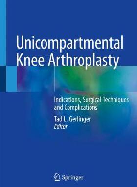 预订 Unicompartmental Knee Arthroplasty