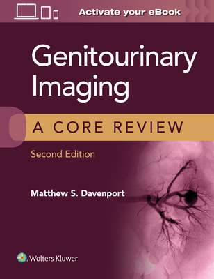 【预订】Genitourinary Imaging: A Core Review