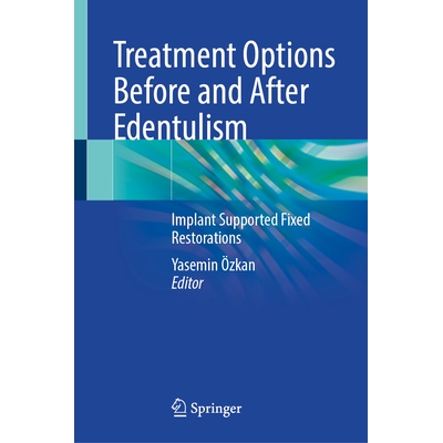 Implant Supported Fixed Restorations