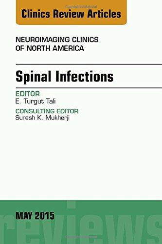 【预订】Spinal Infections, An Issue of Neuroimaging Clinics
