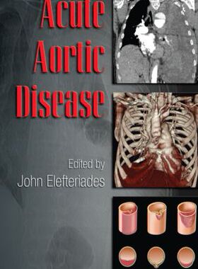 【预订】Acute Aortic Disease