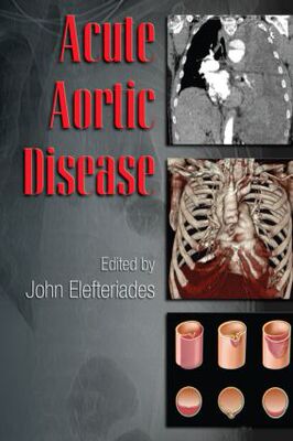 【预订】Acute Aortic Disease