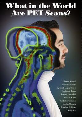 [预订]What in the World are PET Scans? 9781773692326