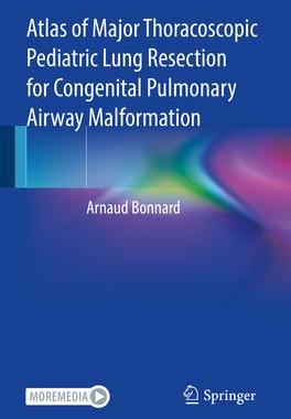 [预订]Atlas of Major Thoracoscopic Pediatric Lung Resection for Congenital Pulmonary Airway Malformation 9783031079399