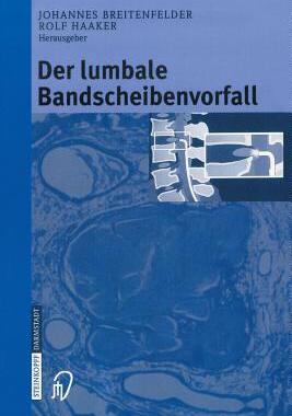 预订 Der lumbale Bandscheibenvorfall