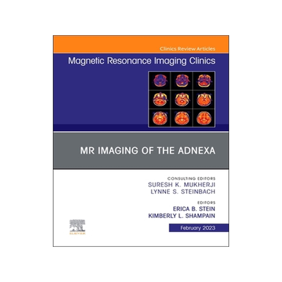 [预订]Vascular Anesthesia, an Issue of Anesthesiology Clinics