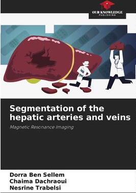 [预订]Segmentation of the hepatic arteries and veins 9786205875988